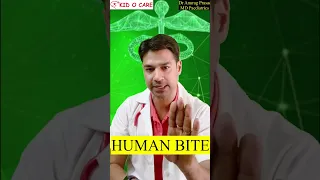 Steps to be followed in HUMAN BITES by Dr Anurag Prasad (Hindi) #shorts