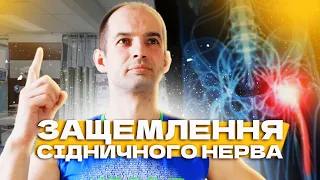 Защемлення сідничного нерва, Лікування вправами, Одразу розблокуй сідничний нерв