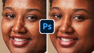 How to Remove Pimples from Face in Photoshop: Skin Retouching & Photo Editing for Beginners