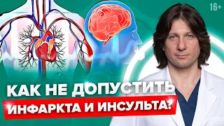 Риск развития инфаркта и инсульта! Как определить и избежать? Что показывает гомоцистеин?