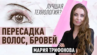 Пересадка волос и бровей. Какая технология самая современная?