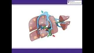 ALPPS procedure animation -- A surgical solution for initially unresectable liver tumours.