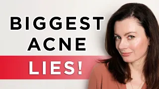 DEBUNKED!! The Top 6 Acne Myths | Dr Sam Bunting