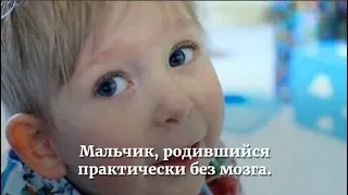 Мальчик без мозга.!?