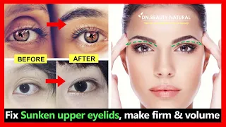 5 exercises Fix Sunken upper eyelids, hollow upper eyelids, Make firm and volume (no filler)