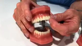 How do you know if you grind your teeth?