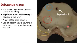 Lecture 6 Brain Stem Anatomy