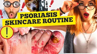 psoriasis skincare routine: The 7 Best Methods You've Never Heard of