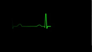 simple animated loopable ekg heart monitor display alpha channel included