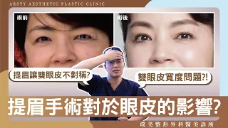 提眉造成雙眼皮不對稱？！內視鏡提眉對於雙眼皮有甚麼影響呢？是否可以改善提眼肌無力的問題