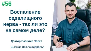 #56 Воспаление седалищного нерва — так ли это на самом деле? Спросите у доктора Василия Чайки