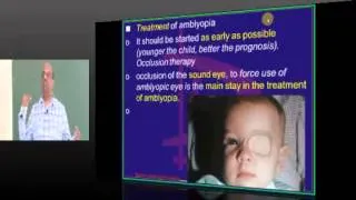 Amblyopia High yield Topic Ophthalmology Med School prep www.anatomy2medicine.com