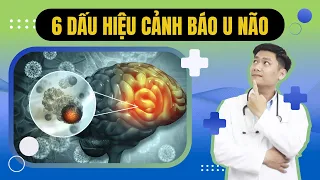 6 DẤU HIỆU CẢNH BÁO U NÃO AI CŨNG CẦN PHẢI BIẾT - Đặc biệt dấu hiệu thứ 6 | Bác sĩ Trường