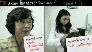 ศิริราช The Life [by Mahidol] ซีรีส์ x-ray ห้องตรวจ ตอน โรคกระเพาะ และ ผมร่วง