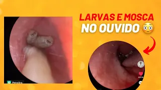 Remoção de larvas e mosca do ouvido 🐛🪰👂🥴😵‍💫😳😱 / myiasis and fly in the ear