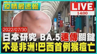 【BA.5防疫情報】日本研究 BA.5"速傳"關鍵　不是非洲!巴西首例猴痘亡LIVE