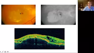 Retinal OCT for Clinicians