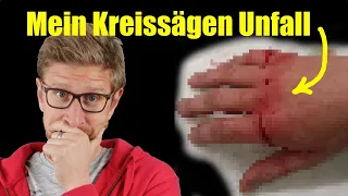 IN DIE HAND GESÄGT | Kreissägenunfall