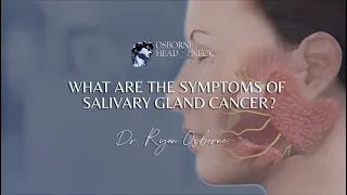 What are the symptoms of salivary gland cancer?