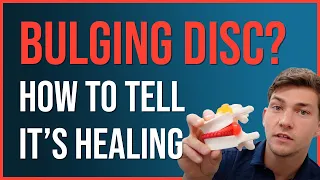 The WEIRDEST Sign a Bulging Disc is Healing!