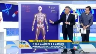 Artrite e artrose: saiba como prevenir e tratar no Você e o Doutor