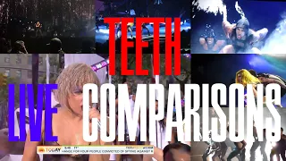 Teeth - Live Comparisons 2017