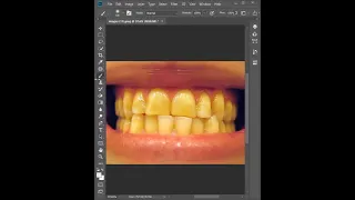 whiten yellow teeth - photoshop tutorial #Shorts