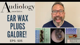 EAR WAX PLUGS GALORE! - EP505