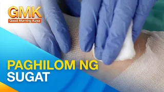 Mga dapat malaman para mabilis na mapaghihilom ang sugat | You Can Do It