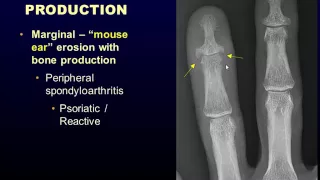 Radiographic Approach to Arthritis