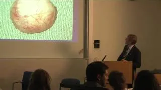 SF Lecture Series 2013 - Oculoplastic Disorders and Reconstruction / Orbital Reconstruction