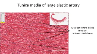 Histology with Chimmalgi: Blood Vessels