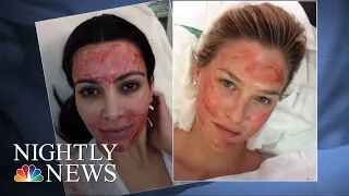 Health Officials Warn Of Potential HIV Risk After Vampire Facial At New MX Spa | NBC Nightly News