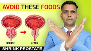 Avoid These Food To Shrink Enlarged Prostate | Foods To Avoid To Have Healthy Prostate
