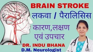 Brain Stroke in Hindi | लकवा क्या होता है | लकवा कैसे पहचाने | लकवा के लक्षण | Stroke Treatment