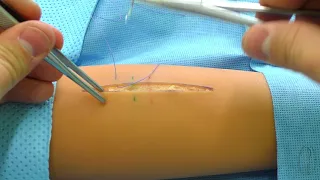 Simple interrupted suture making technique