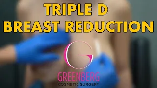 Breast Reduction (TRIPLE D BREASTS) | Greenberg Cosmetic Surgery