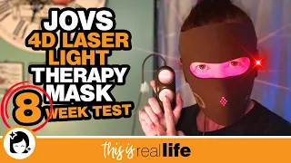 JOVS 4D Laser Light Therapy Mask - 8 Week Test - THIS IS REAL LIFE