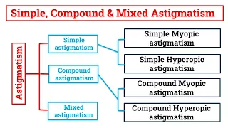 Simple, Compound & Mixed Astigmatism- Complete Tutorial