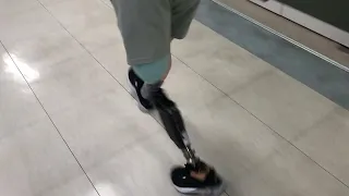 Trying on prosthetic knee joint in Korea