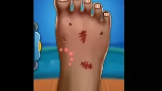 foot doctor animations for kids - reacting to kids animations (2 billion views  = one video)
