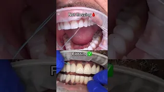 The Absolute BEST Way To Floss Your Teeth! 🦷🪥