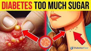 10 Warning Signs You're Eating Too Much Sugar