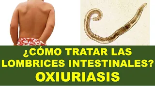 🔴 Lombrices intestinales que causan prurito perianal (Oxiuriasis) Síntomas, Tratamiento y Prevención