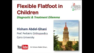 Flexible Flatfoot in Children