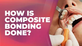 How is composite bonding done? | Cosmetic Dentist Preston