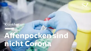 Affenpocken: Drei Gründe, warum Affenpocken nicht das neue Corona sind