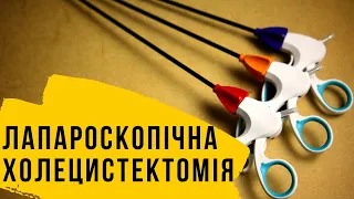 Лапароскопічна холецистектомія з поясненнями. Або як видаляють жовчний міхур?