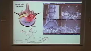 Dr Tamburin - Anatomia funzionale del dolore e fisiopatologia del dolore neuropatico