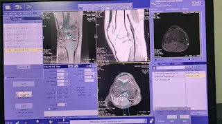 Mri knee technique